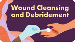 Wound Series Resource 2 - Wound Cleansing and Debridement